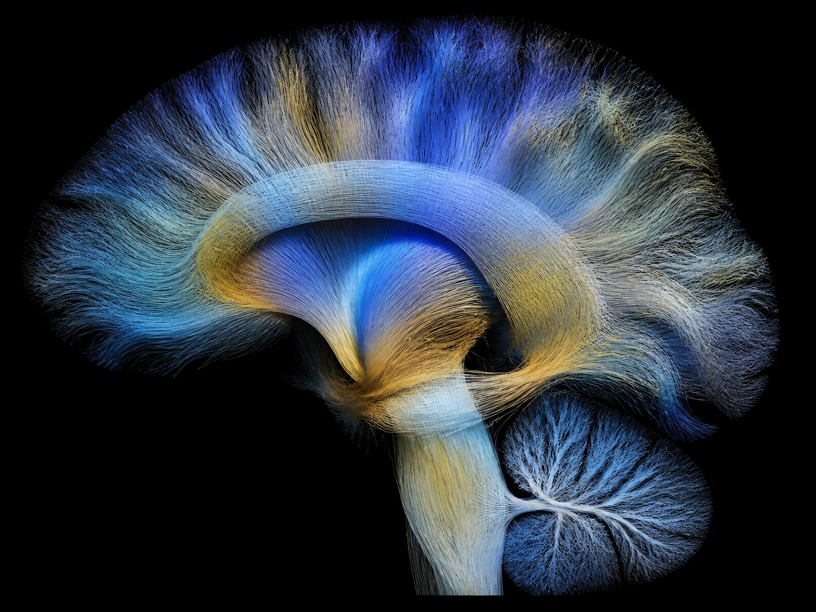 Conceptual tractography-inspired visualization of white-matter pathways in sagittal view